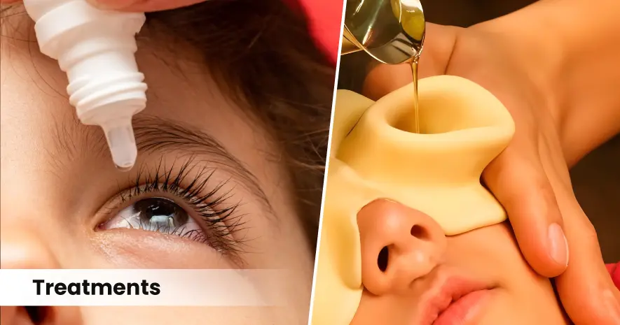 Ayurvedic Treatment for Eye Infections in Babies and Children