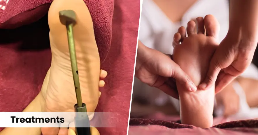 Ayurvedic Treatment for Plantar Fasciitis (Vatakantaka)