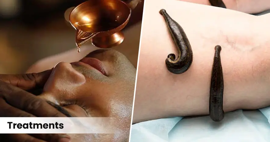 Ayurvedic approach to Allergy Management