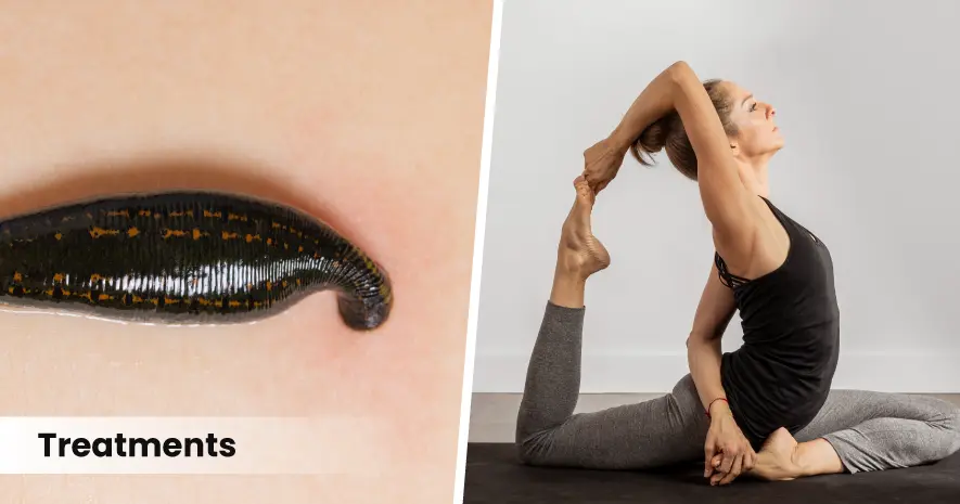 Ayurvedic Management of Sciatica (Gridhrasi)
