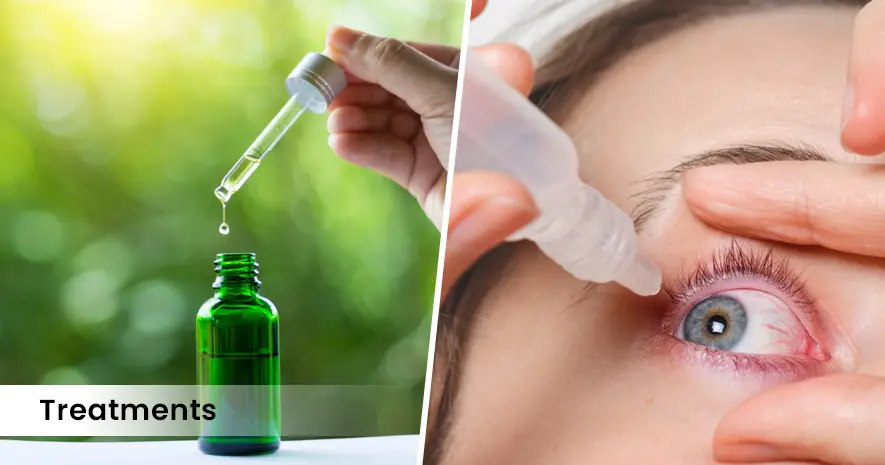 Eye Allergies Treatments