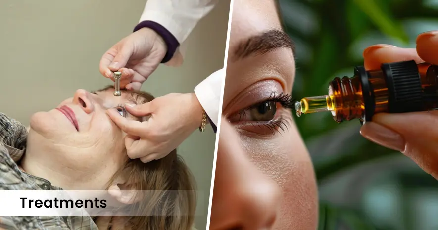 Pink Eye (Conjunctivitis) Treatments