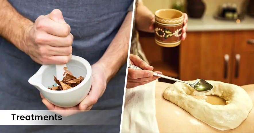 Ayurvedic treatment for Irritable Bowel Syndrome 