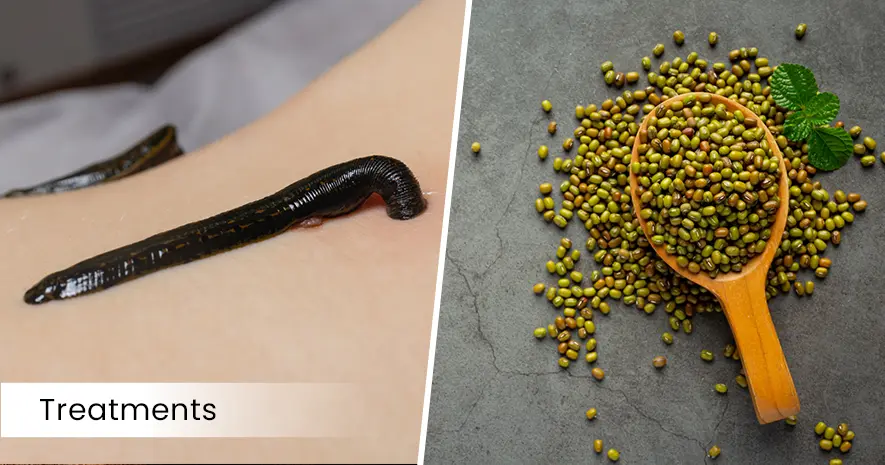 Gout (Vatarakta) treatment in Ayurveda