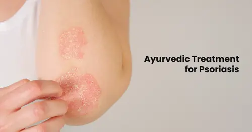 Ayurvedic Treatment for Psoriasis