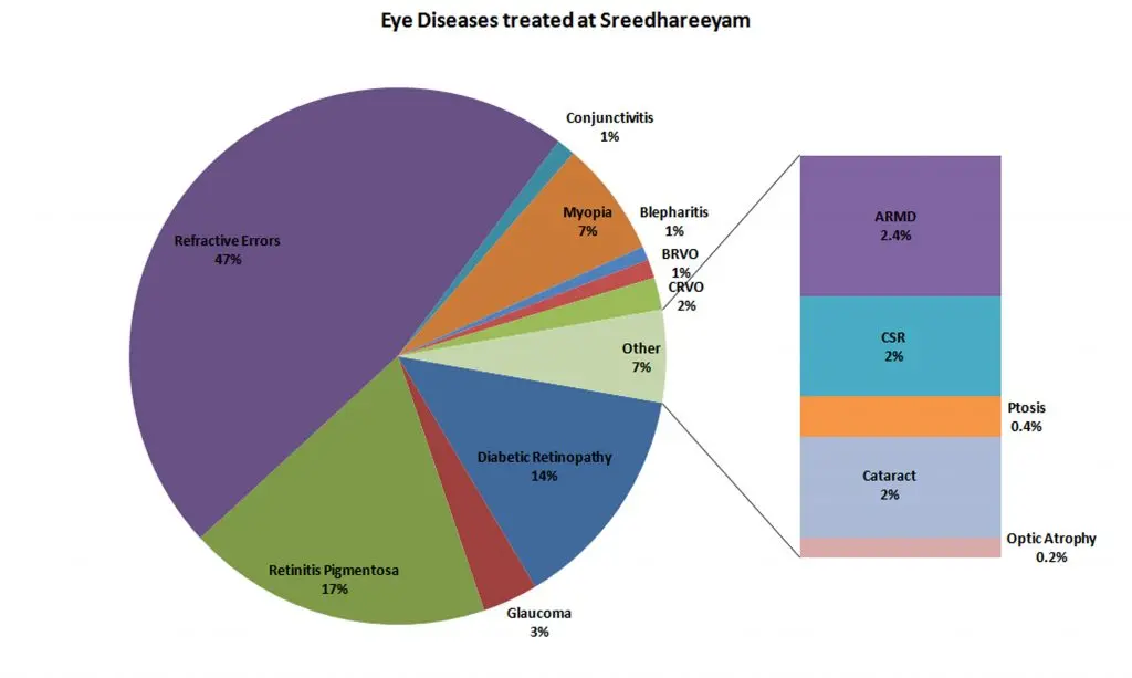 Major Eye Diseases treated at Sreedhareeyam
