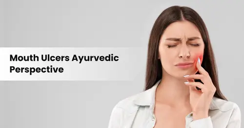 Ayurvedic Approach for Mouth Ulcer