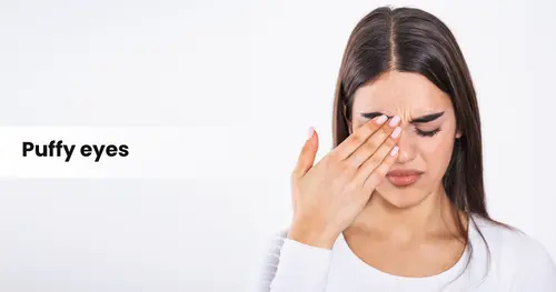 Ayurvedic Treatment for Puffy Eyes