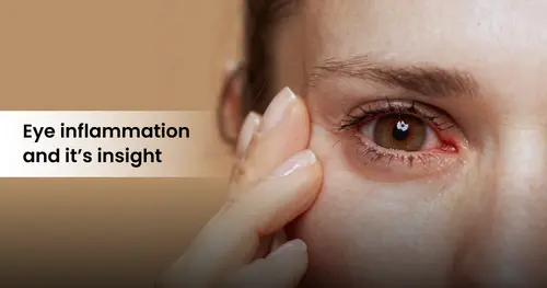 Eye inflammation and Ayurvedic insights