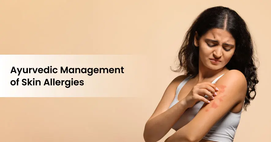 Ayurvedic Management of Skin Allergies