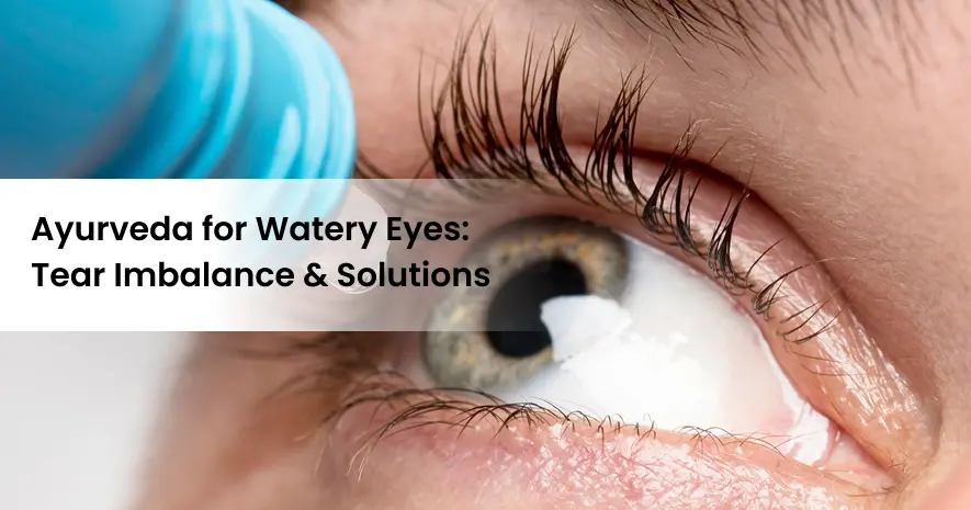 Ayurveda for Watery Eyes: Understanding Tear Imbalance & Solutions