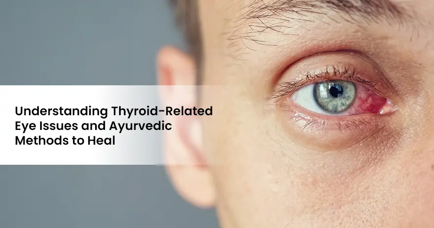 Understanding Thyroid-Related Eye Issues and Ayurvedic Methods to Heal