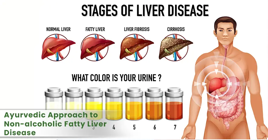 Reclaiming Liver Health – An Ayurvedic Approach to Non-alcoholic Fatty Liver Disease (NAFLD)