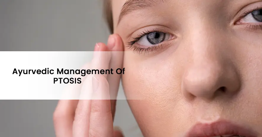 Ayurvedic Management of PTOSIS / Vatahata Vartma (or Vartma Sthambha/Sankocha)