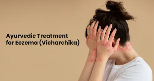 Ayurvedic Treatment for Eczema (Vicharchika): A Comprehensive Approach 