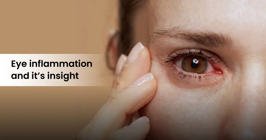 Eye inflammation and Ayurvedic insights