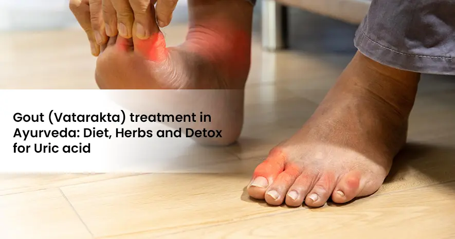 Gout (Vatarakta) treatment in Ayurveda: Diet, Herbs and Detox for Uric acid 