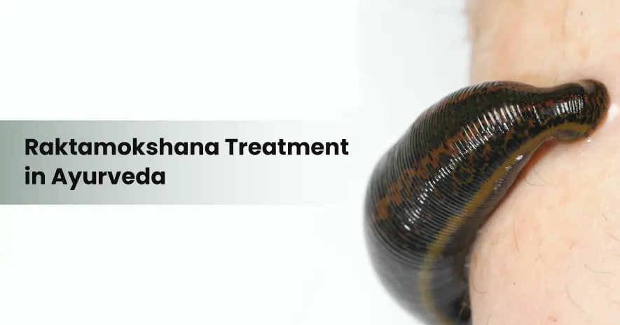 Raktamokshana Treatment in Ayurveda