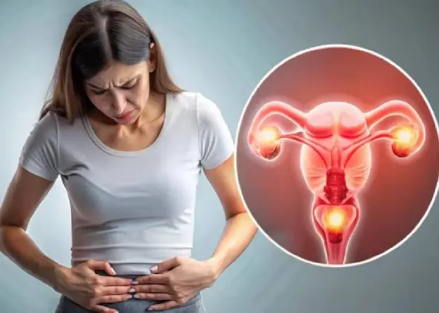 Polycystic Ovarian Syndrome (PCOS)