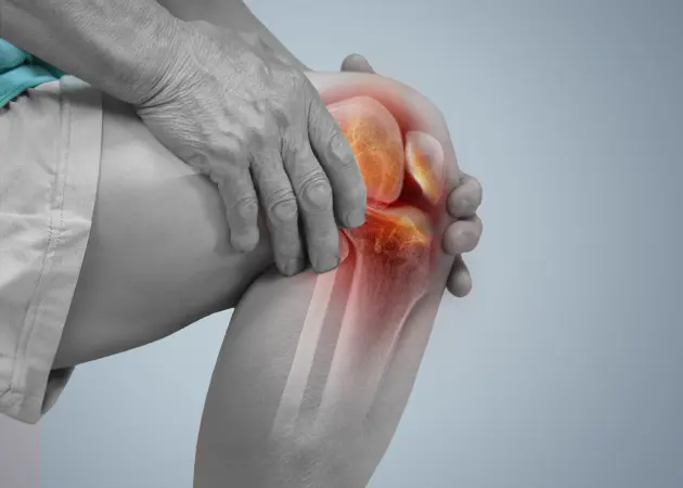 Rheumatoid Arthritis